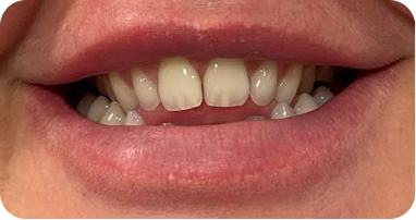 Case 1 Before