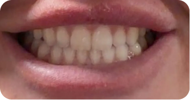 Case 1 After