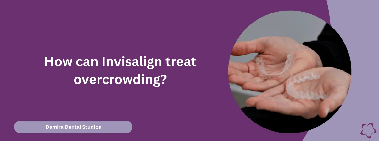 How can Invisalign treat overcrowding