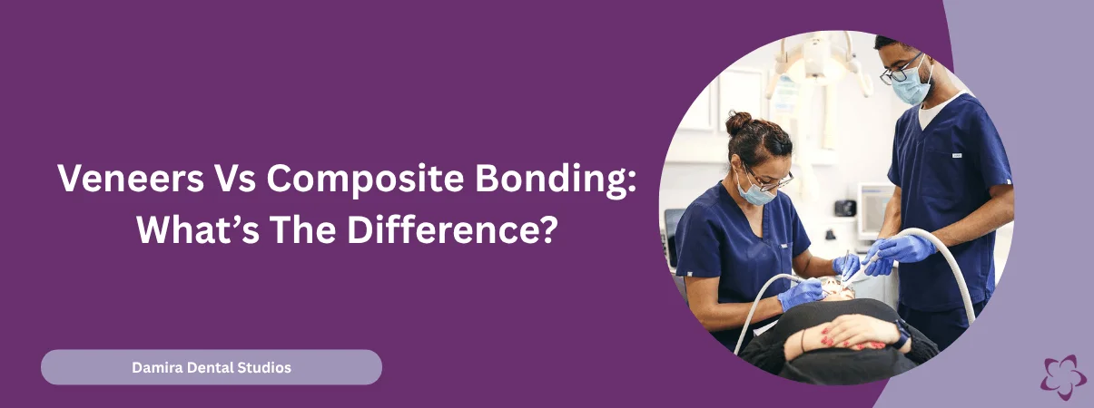 Whats The Difference Between Veneers Vs Composite-Bonding
