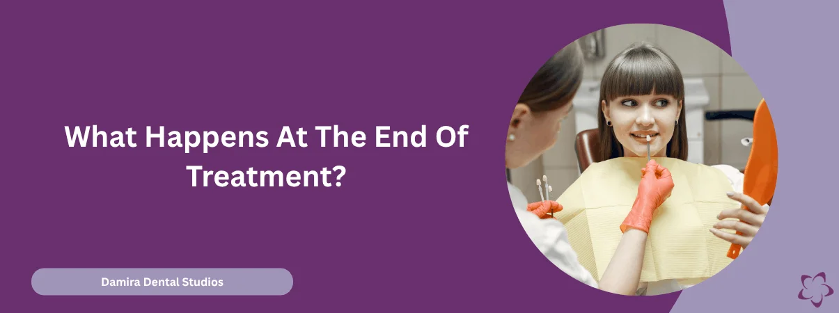 What Happens At The End Of Composite Bonding or Veneer Treatment